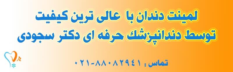 لمینت دندان